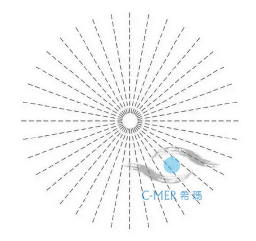 散光如何矯正